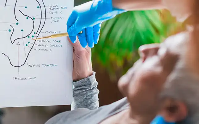 auriculotherapy